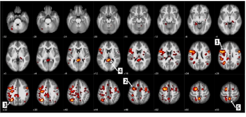 UNIVERSIDAD DE ALBERTA